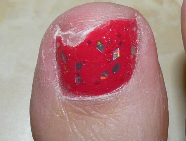 Cracked Nail Repair 