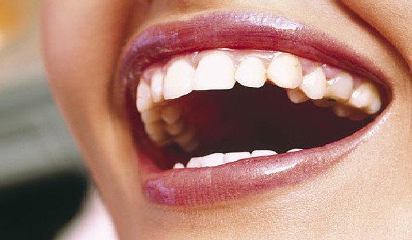 Whiter teeth