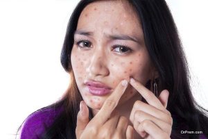pimple