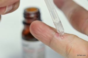 Remove warts naturally