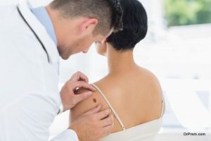 SKIN CANCER