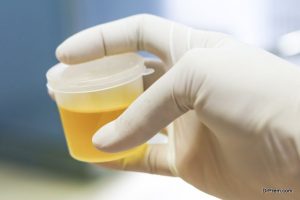 urine sample