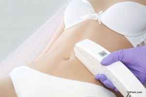 Laser Hair Removal