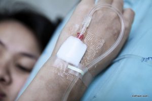 Chemotherapy