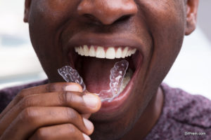 Invisible aligners