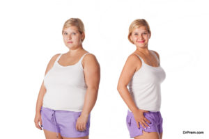 tummy tuck