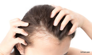 Prevent Hair Loss