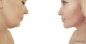 get-rid-of-face-fat-naturally