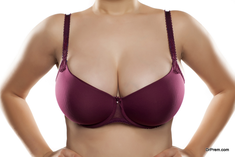 breast asymmetry corrected with an augmentation