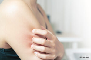 itchy skin